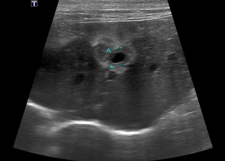 Pancreatitis in Cats Clinician's Brief