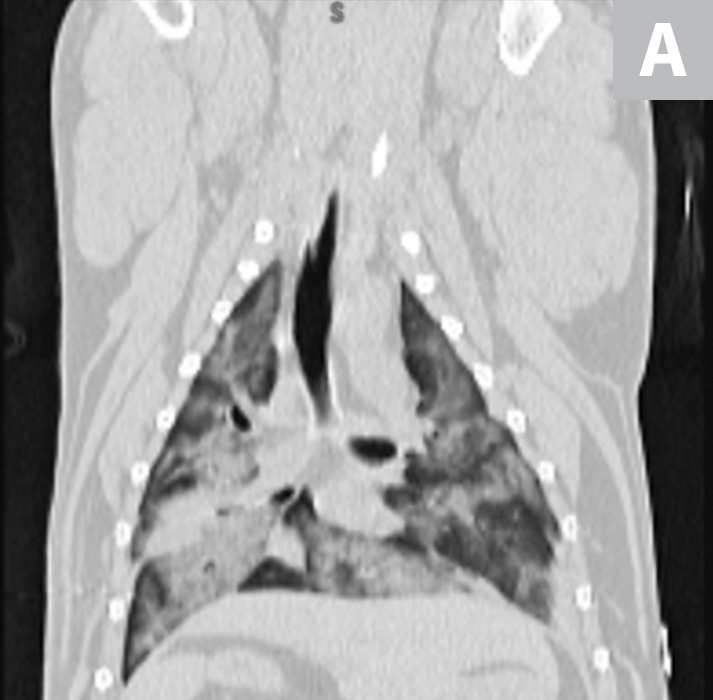 Acute Respiratory Distress Syndrome in Dogs & Cats | Clinician's Brief