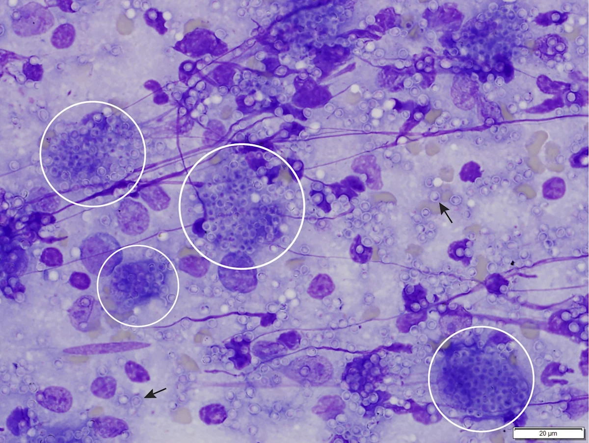 Numerous yeast organisms in a bone marrow aspirate from a cat.