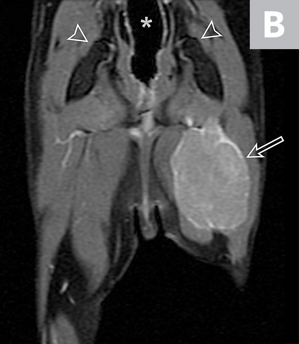 Feline Malignant Nerve Sheath Neoplasm Clinician's Brief