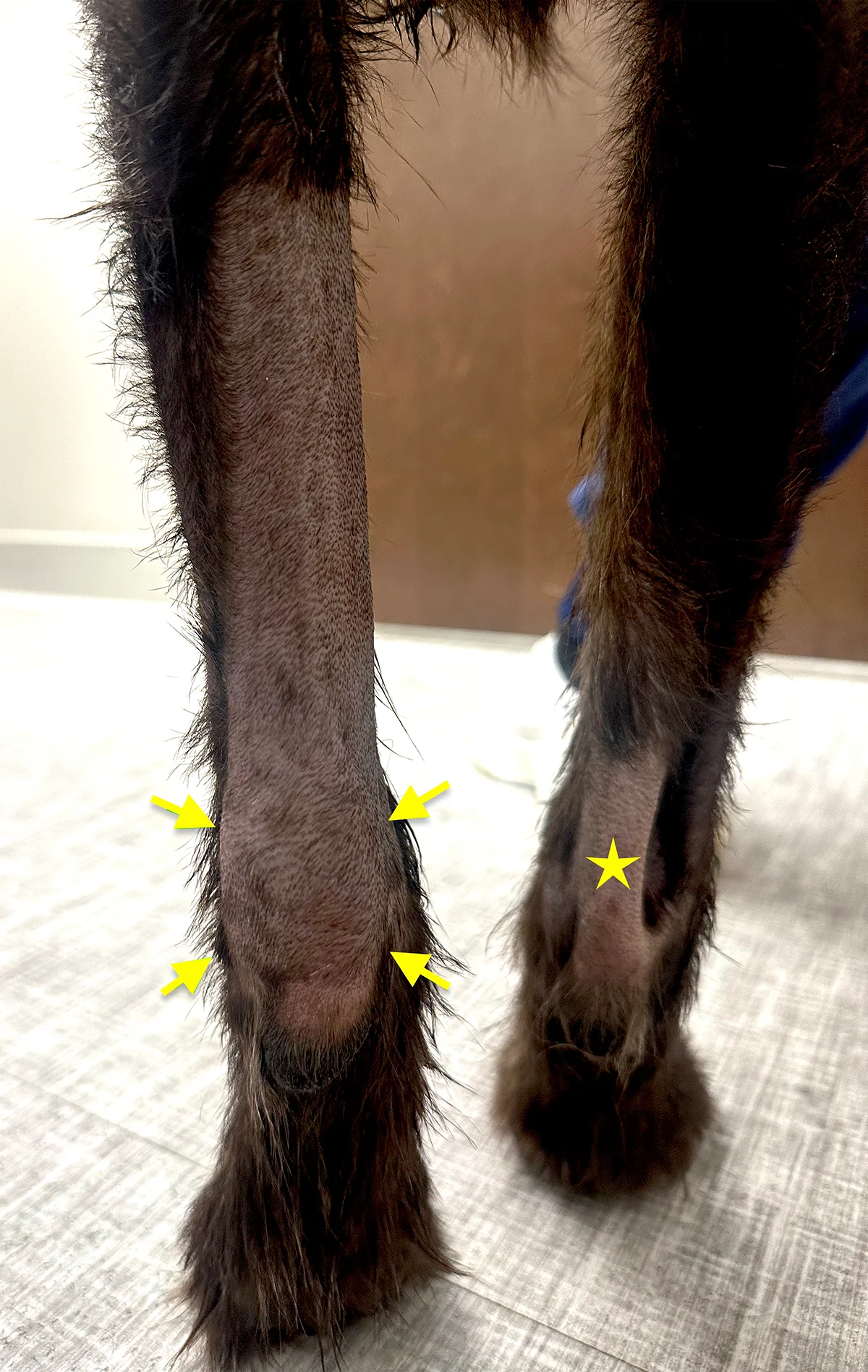 Caudal aspect of shaved antebrachia in dog showing abnormally thickened tendon on left limb and normal tendon on opposite limb.
