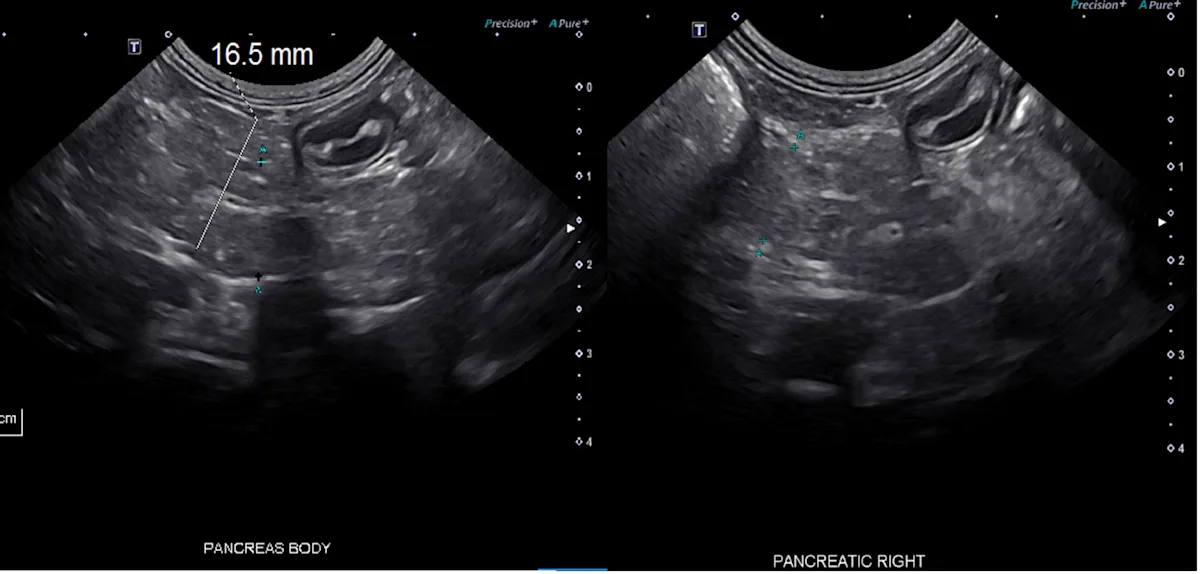 Ultrasound images of a canine pancreas showing changes consistent with chronic pancreatitis.