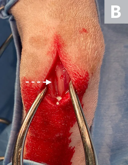 Intraoperative image showing clamps widening skin incision to expose labeled areas of interest.