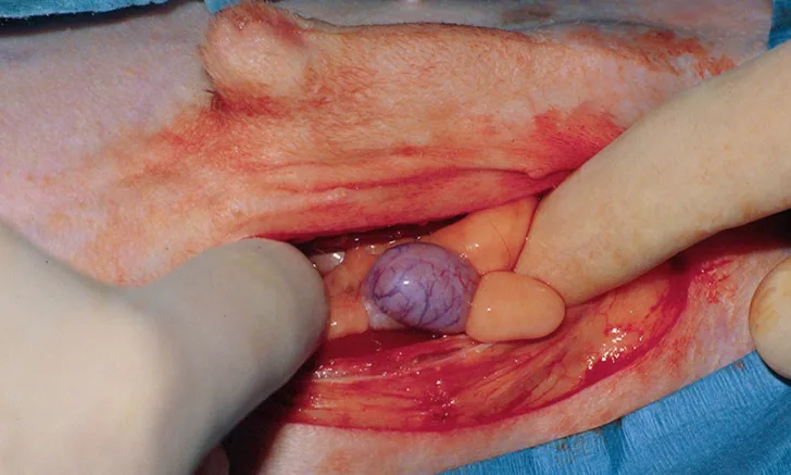 Gloved hands are retracting tissue from a cryptorchid testicle that is visible via a paramedian incision. 