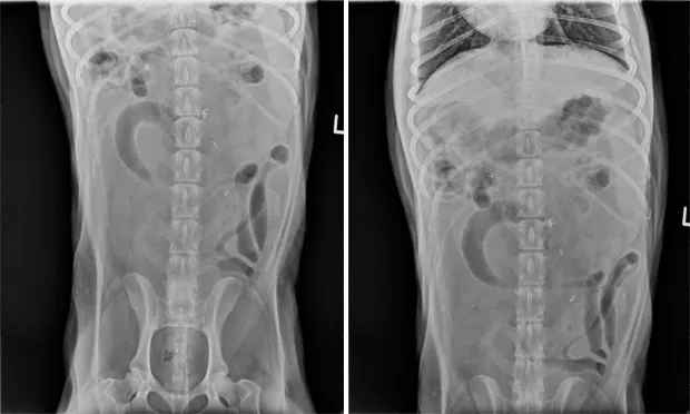 The Case: Misdiagnosed Vomiting