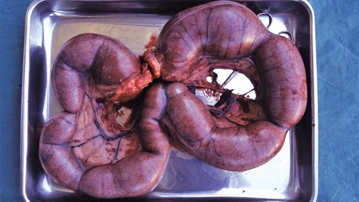 Engorged uterus removed from dog lying on metal tray.