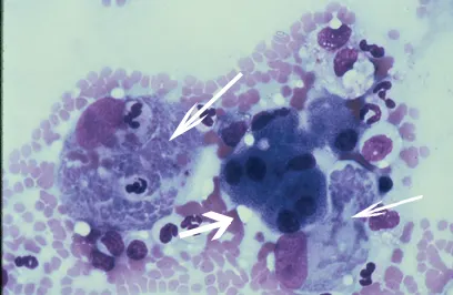 Liver cytology showing arrows pointing to very small dark-staining organisms within a macrophage.