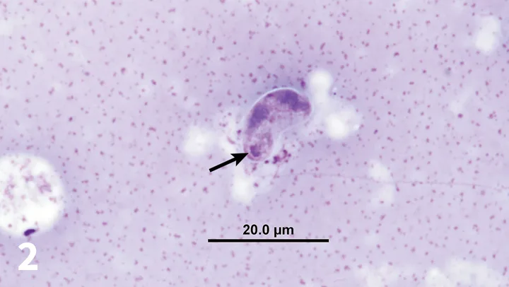Cytology showing kidney-shaped organism with clear outer wall and arrow pointing to purple intracellular structures.