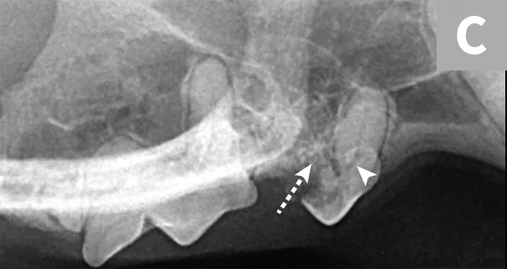 Three radiographic images demonstrating the features of Type 1, 2, and 3 tooth resorption.