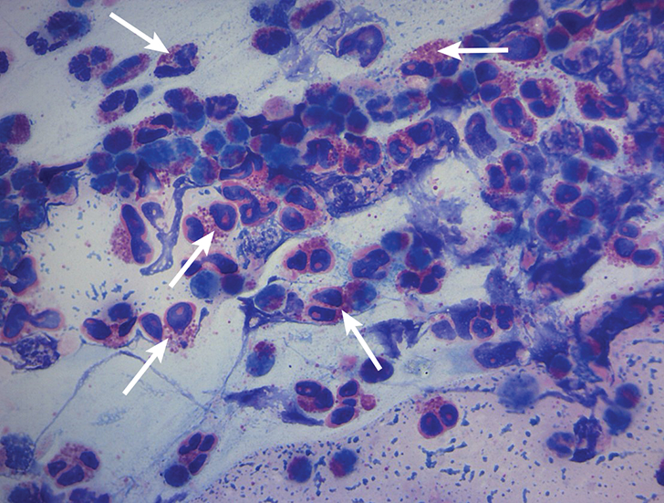 Chronic & Persistent Coughing in a Dog Clinician's Brief