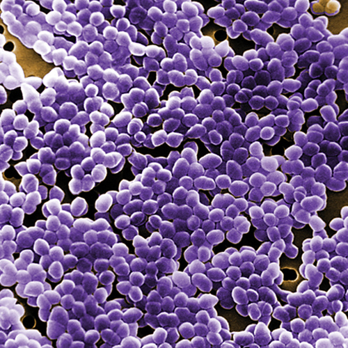 MultidrugResistant Enterococcal Infections Clinician's Brief