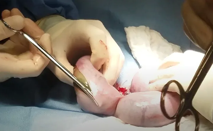 Gloved hands incising gravid exteriorized uterus using Metzenbaum scissors.