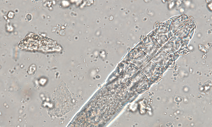 Surprises on Microscopic Fecal Examination