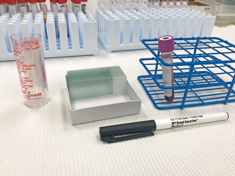 Black marker, blood tube in test tube rack, container of hematocrit tubes, and half-empty box of glass slides.