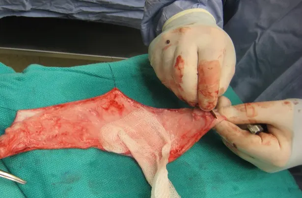 Subcutaneous tissue of a dog being removed from the skin graft with a scalpel blade.