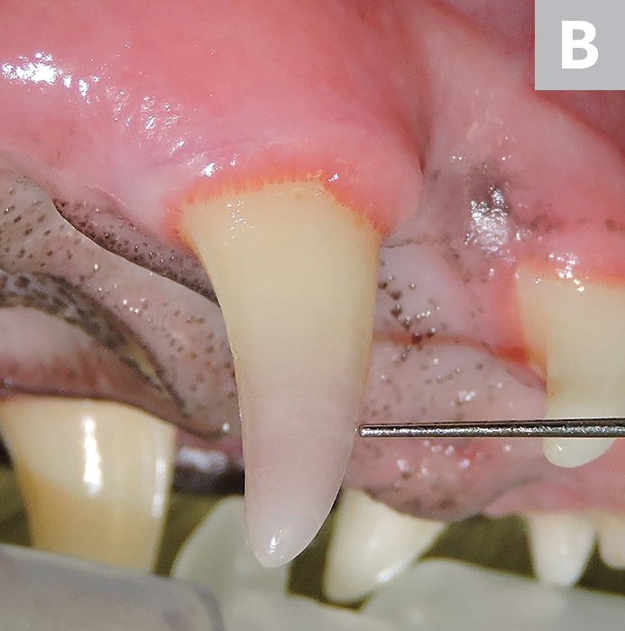 Top 5 Methods for Assessing Tooth Vitality Clinician's Brief