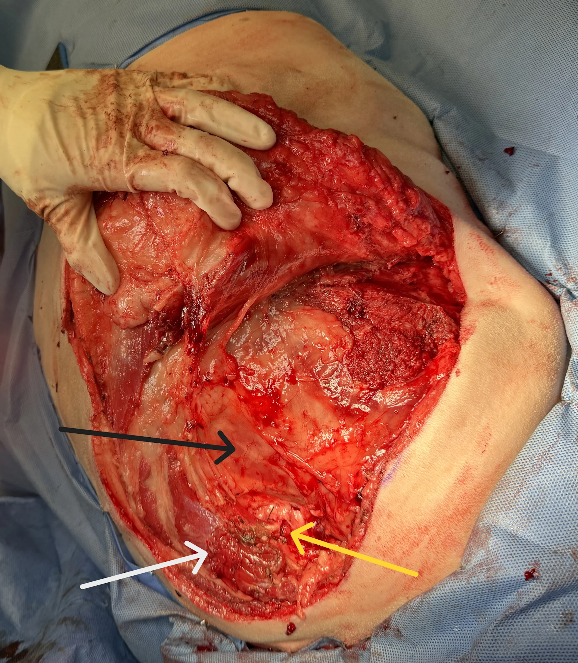 selected slide image