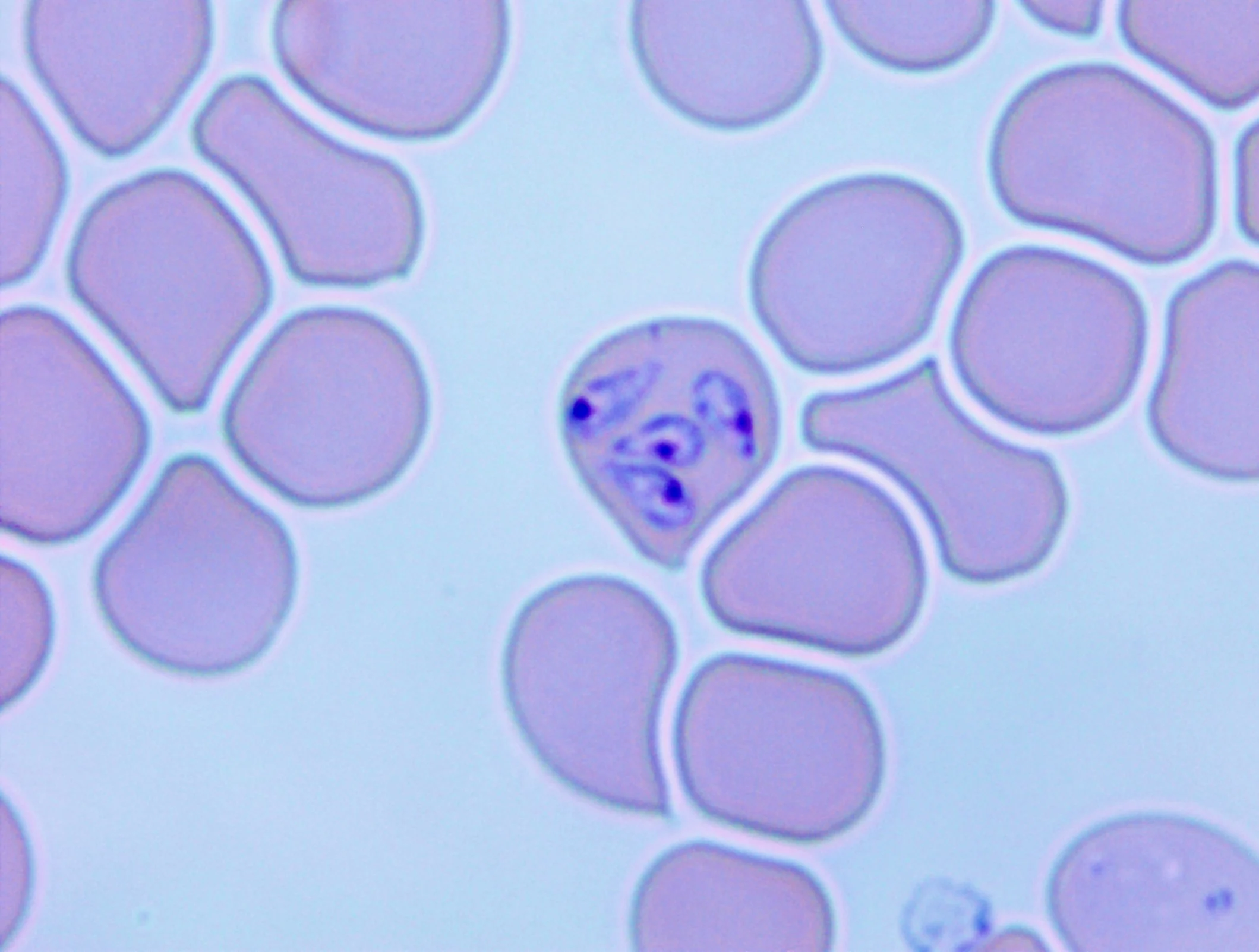 Slide showing merozoites.