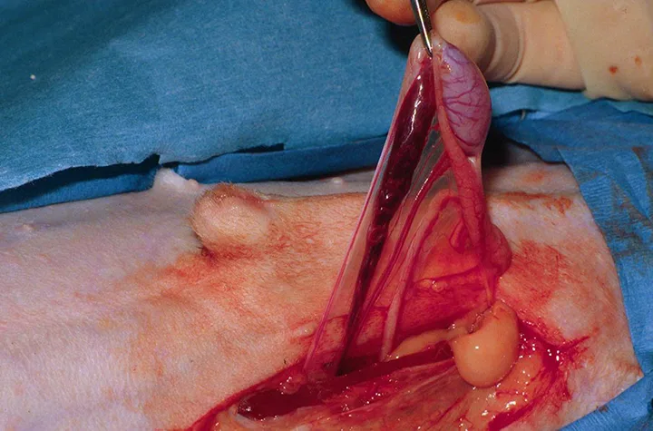 A cryptorchid testicle has been located and exteriorized through the paramedian incision. 