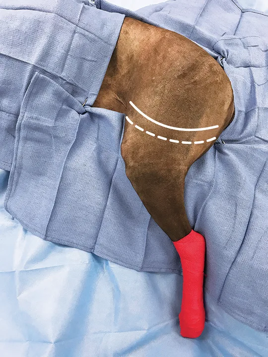 Lines drawn over image of surgically draped canine pelvic limb showing where incisions will be made.