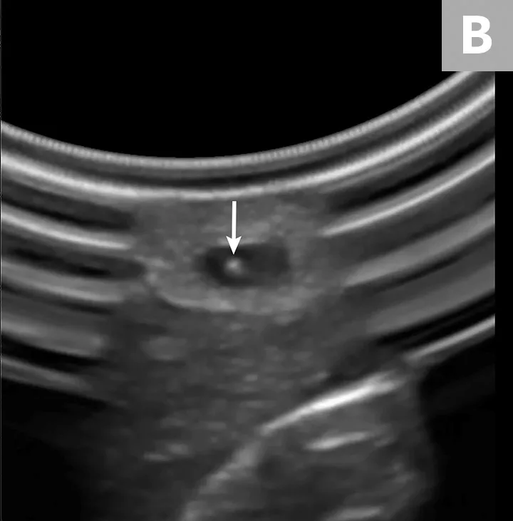 Ultrasound probe held over limb of pet and ultrasound image with arrow pointing to needle seen within blood vessel.