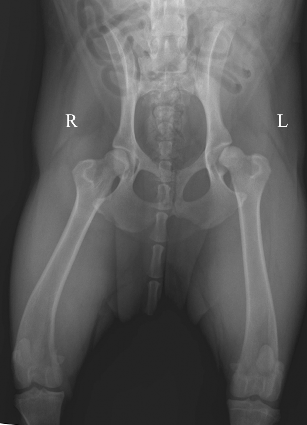 Pelvis x-ray Information