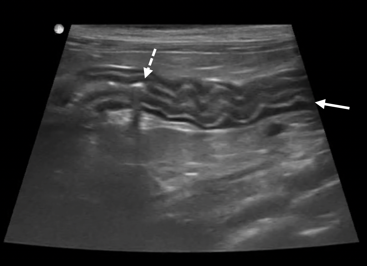 chronic-enteropathy-in-cats-clinician-s-brief