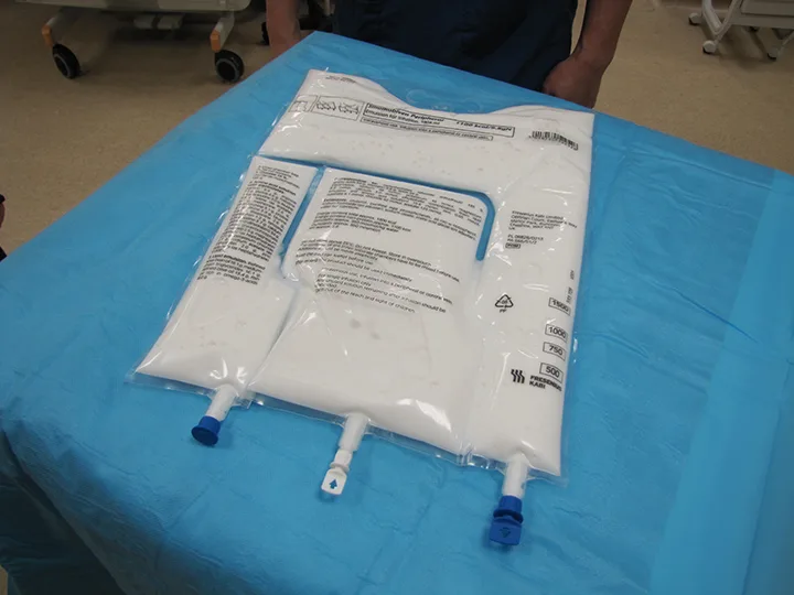 IV bag filled with milky white fluid lying on surgical drape.