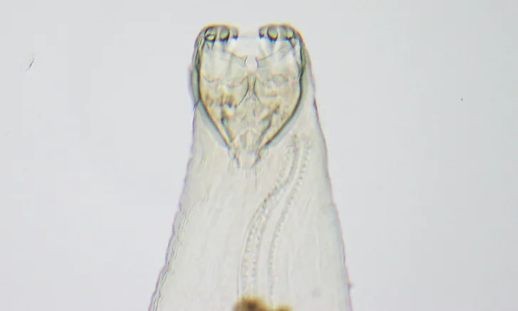 microscopic view of a hookworm