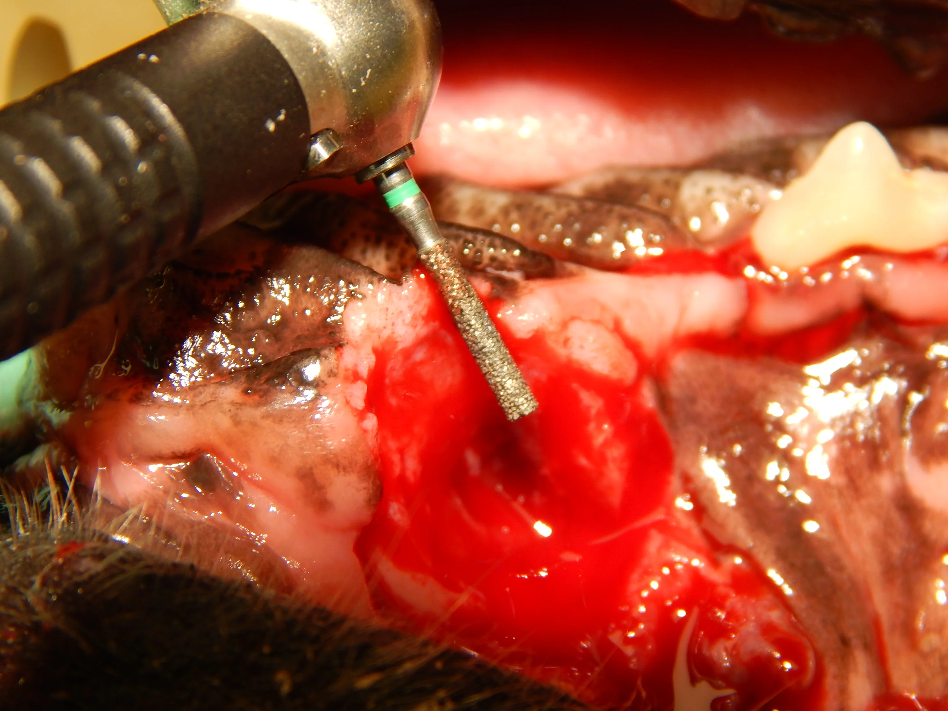 Two photographs showing the use of a diamond burr to facilitate healing of a mucogingival flap. 