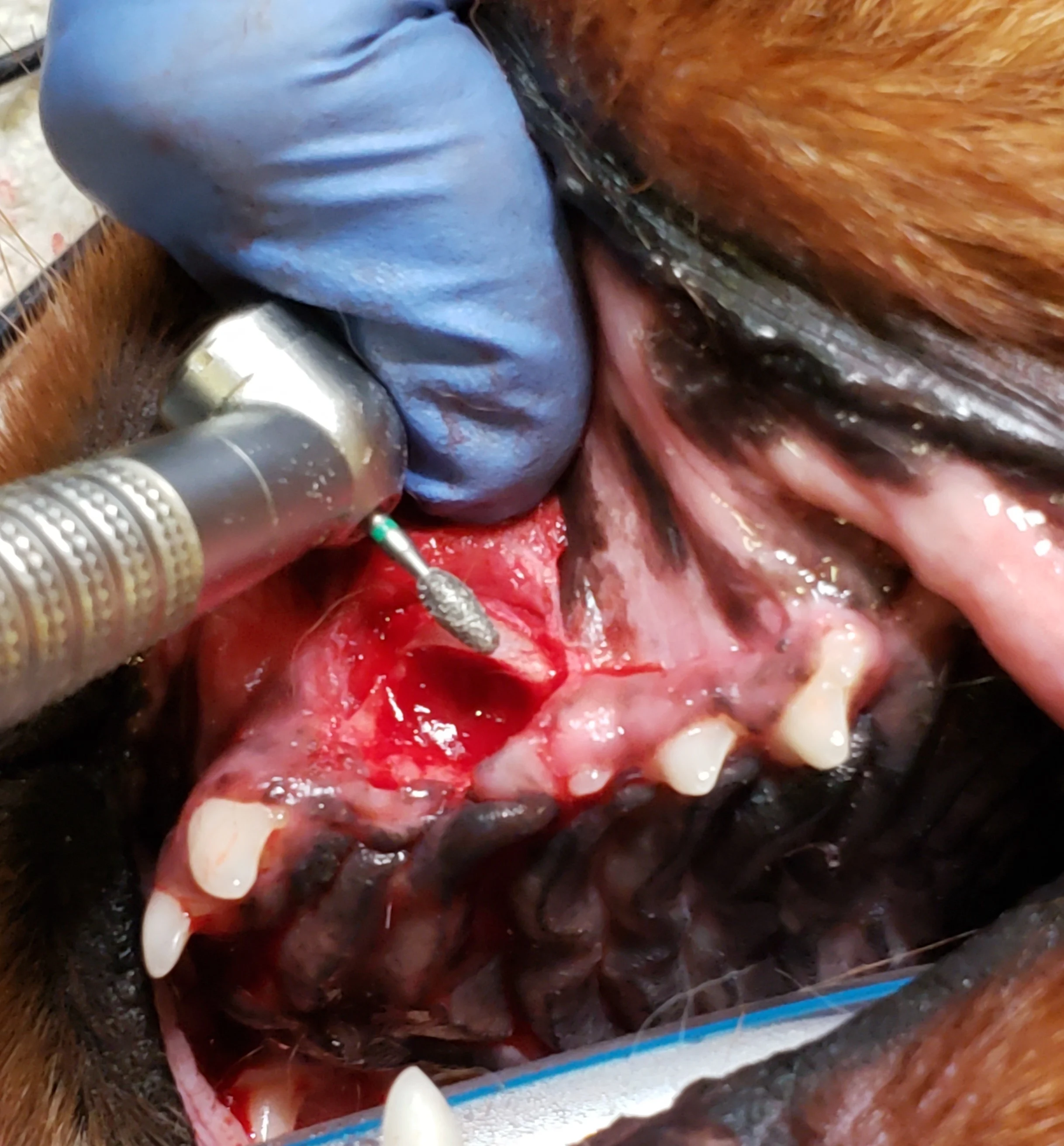 Dental bur held against edge of alveolar bone at the site of canine tooth removal.
