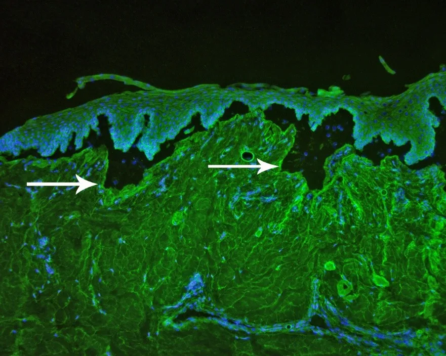 Fluorescent green and blue image of canine skin with arrows pointing to immunoglobulin G autoantibodies.