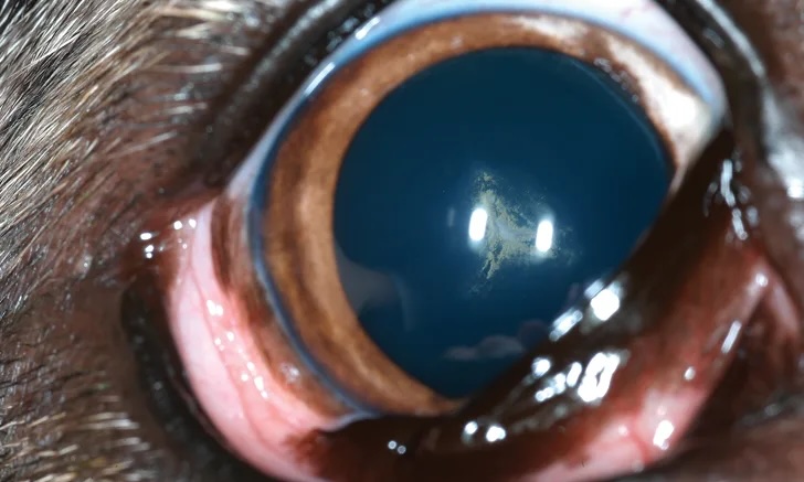 View of Clinical Image: Cataract
