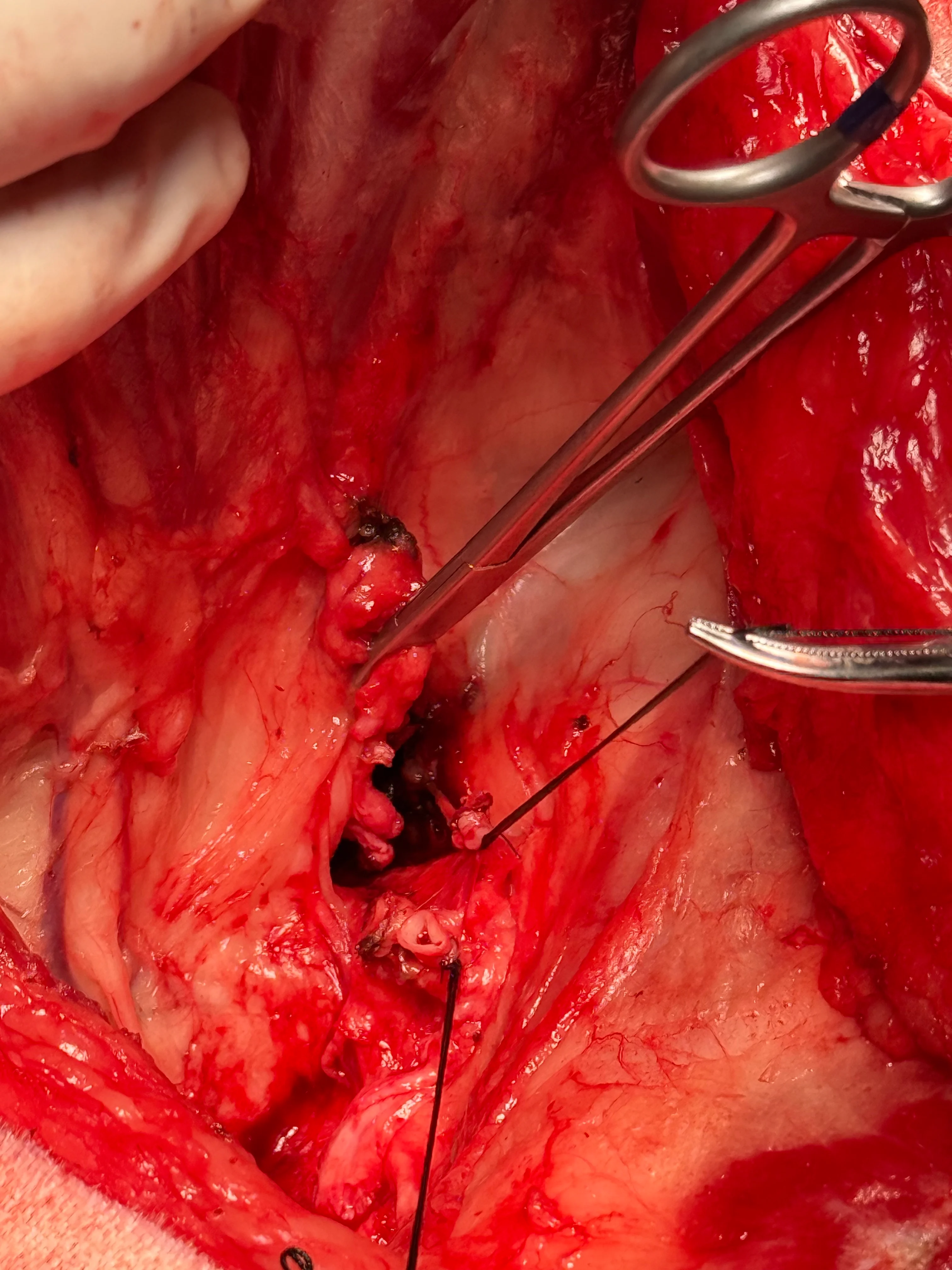 Long pedicle tags seen during limb dissection of a dog.
