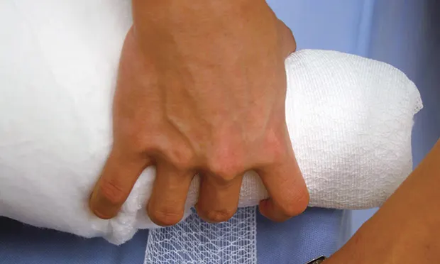 A hand applying conforming gauze to a patient’s foot.