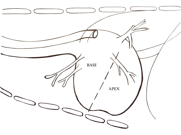 selected slide image