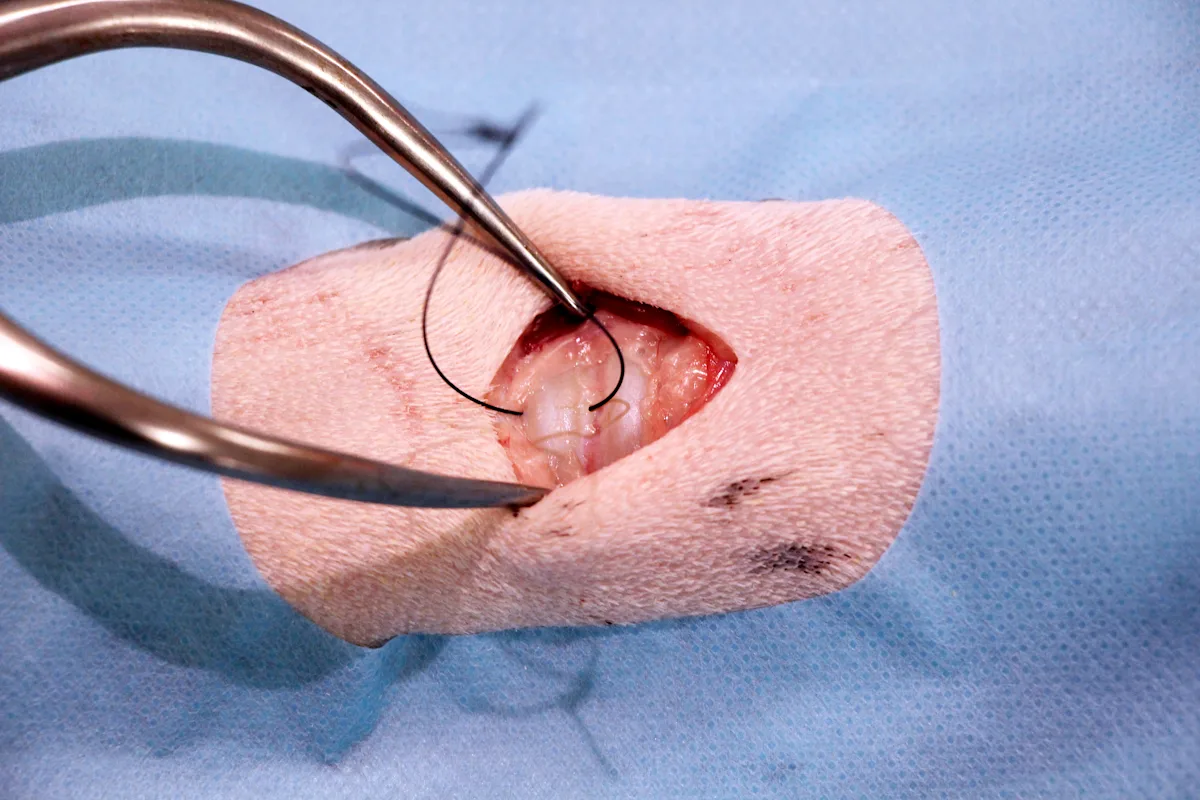 Sutures being placed around tracheal rings in preparation for tracheostomy.