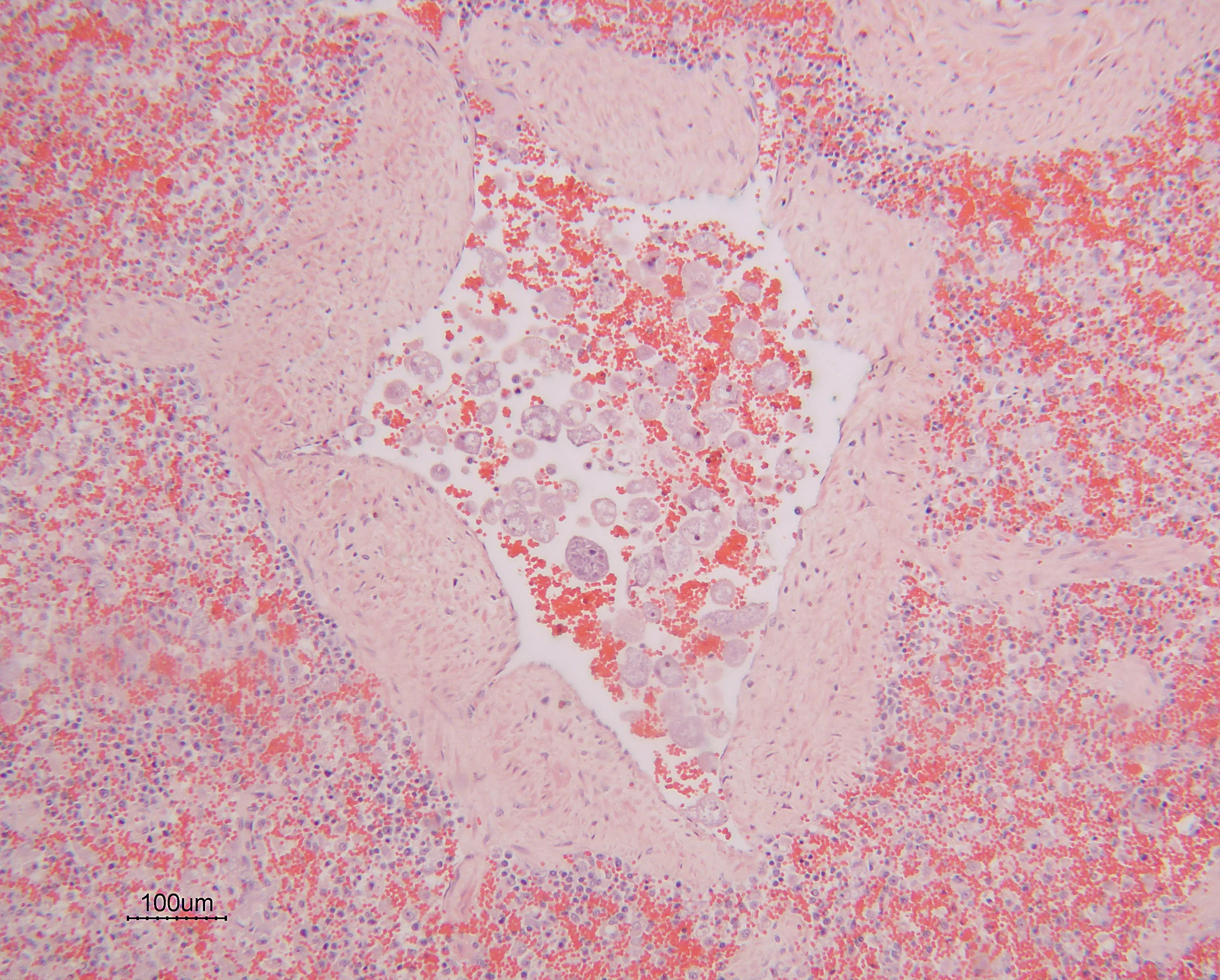 selected slide image