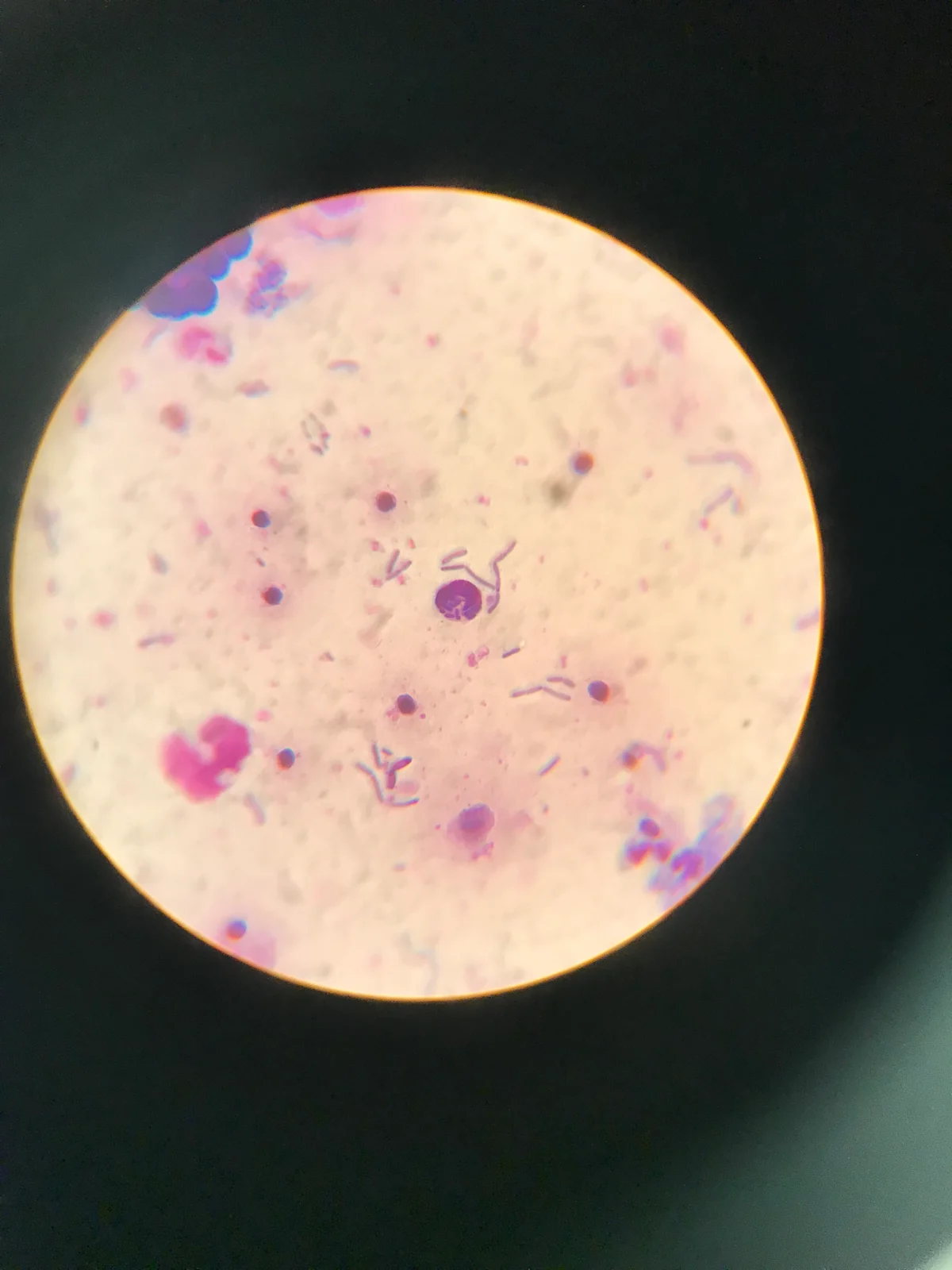 Photomicrograph of pleural fluid from dog.