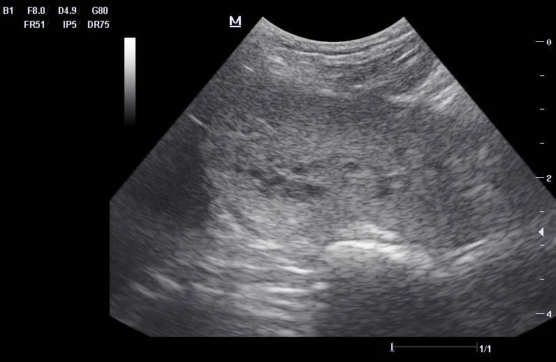Ultrasound image of a canine prostate with small cysts.