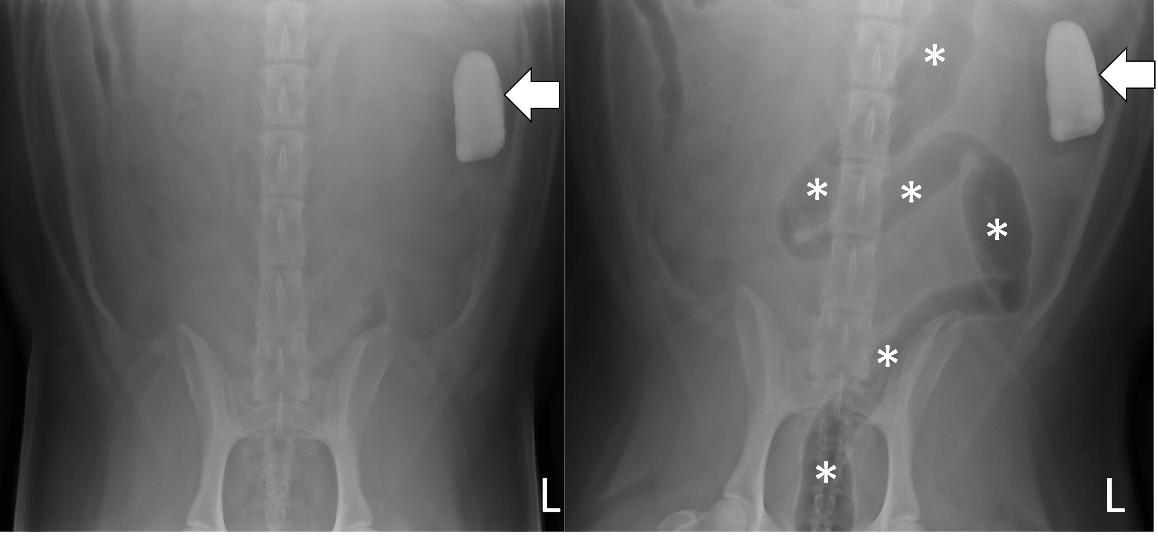 Two ventrodorsal abdominal radiographs of a dog showing before and after a pneumocolonogram.