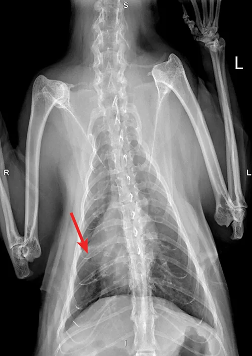 Clinical Image: Radiographic Finding