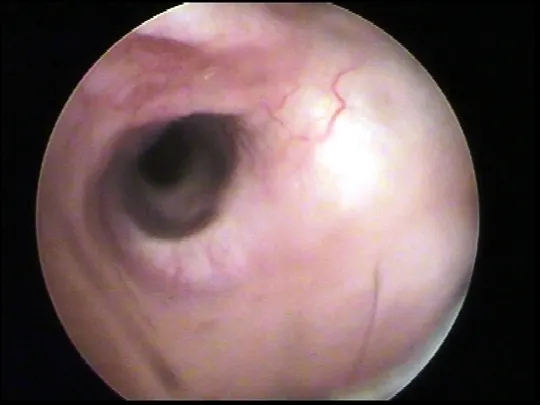 selected slide image