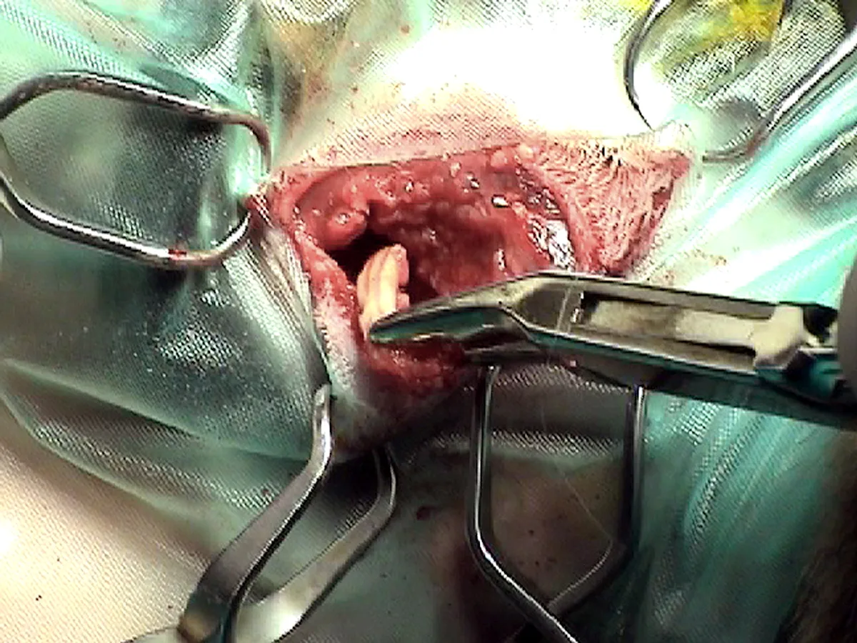 selected slide image