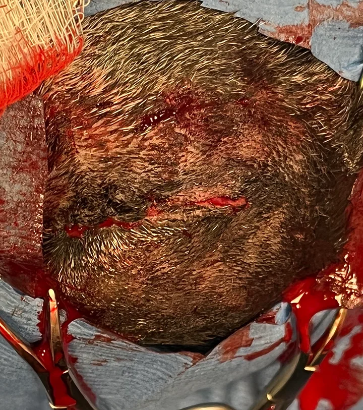 Images demonstrating closure of internal layers of enucleation site.