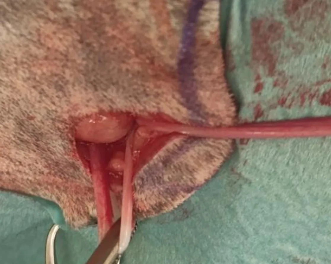Surgical instrument being used to exteriorize a uterine horn; exteriorized second horn also visible on surgical drape.