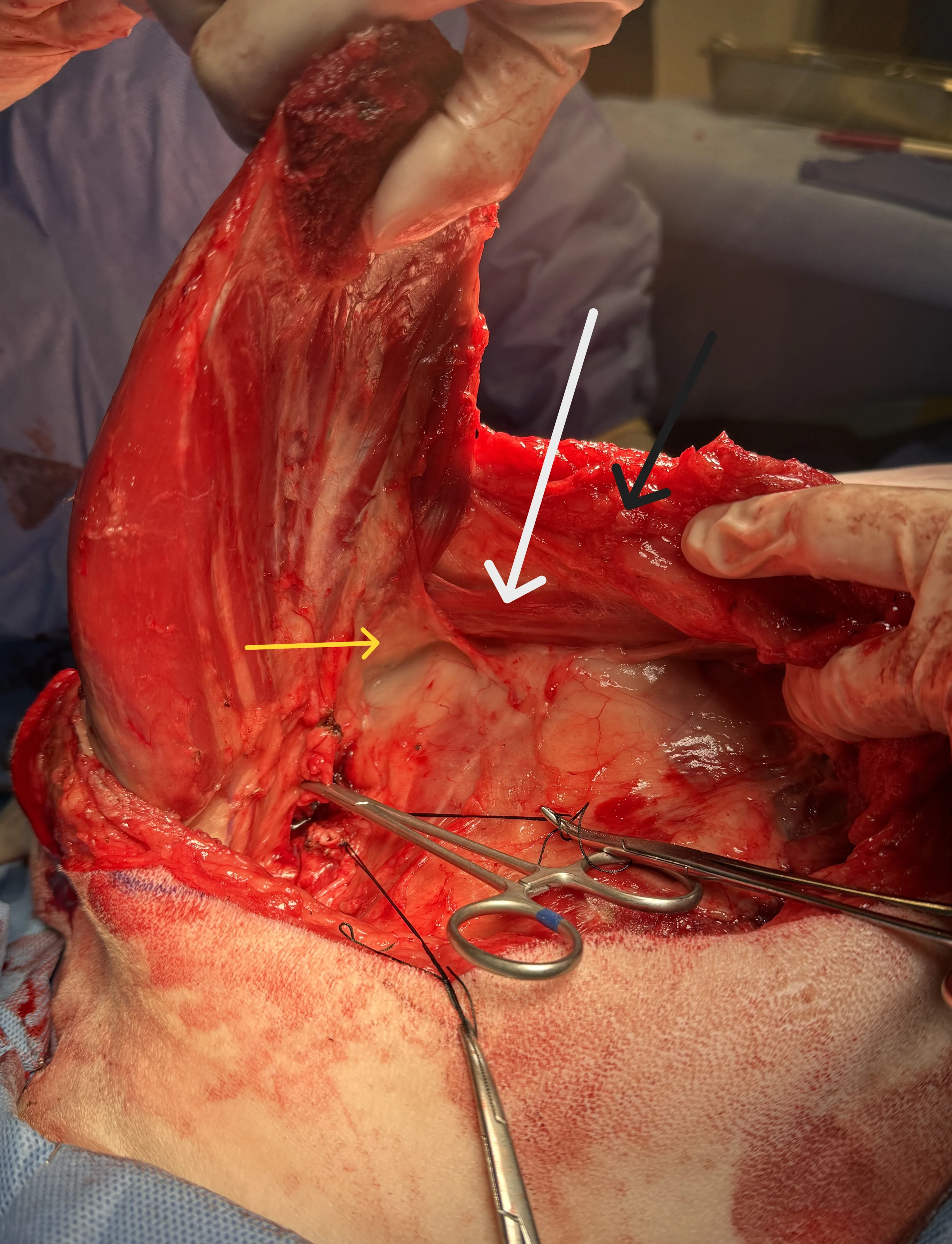 Internal view of the dissection process of the limb of a dog.