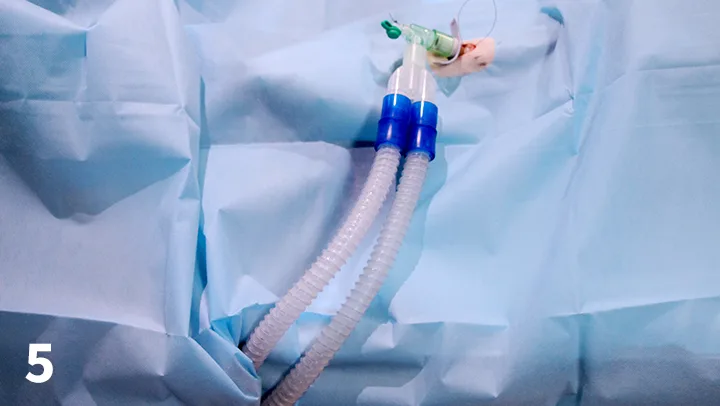 Draped dog with tracheostomy tube in place and attached to anesthesia machine tubing.