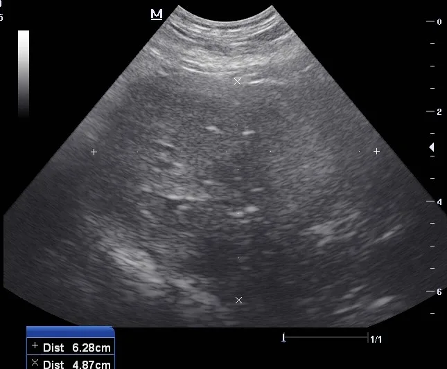 Two ultrasound images demonstrating heteroechogenic appearance of a dog’s prostate.