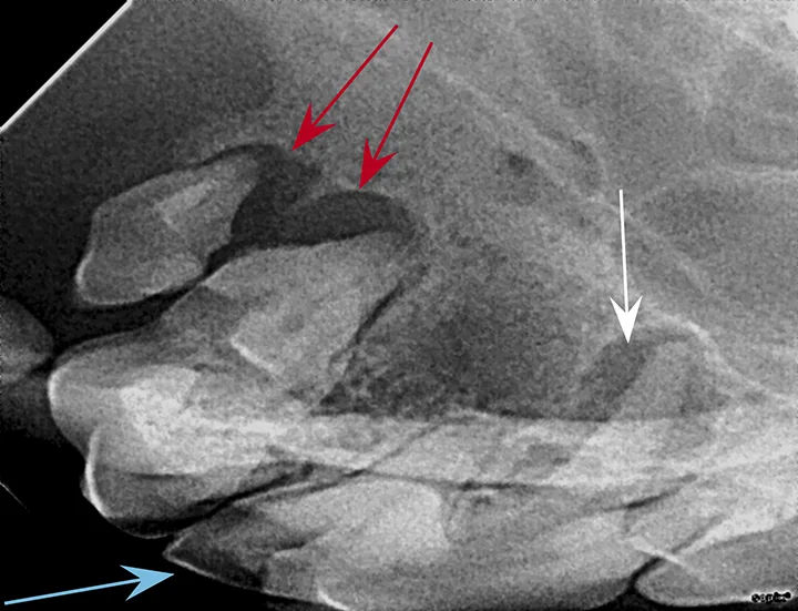 selected slide image